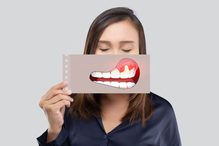 An Asian woman in a dark blue shirt holds a paper with an illustration of periodontal disease in front of her mouth, highlighting gum health issues.